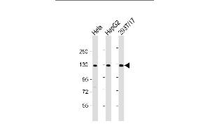 All lanes : Anti-LRIG3 Antibody (N-Term) at 1:2000 dilution Lane 1: Hela whole cell lysate Lane 2: HepG2 whole cell lysate Lane 3: 293T/17 whole cell lysate Lysates/proteins at 20 μg per lane. (LRIG3 抗体  (AA 23-54))