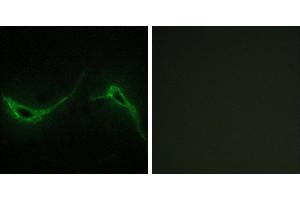 Peptide - +Immunohistochemistry analysis of paraffin-embedded human brain tissue using ADCY7 antibody.