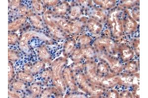 Detection of MCP1 in Rat Kidney Tissue using Polyclonal Antibody to Monocyte Chemotactic Protein 1 (MCP1) (CCL2 抗体  (AA 24-148))