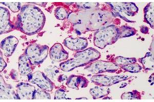 Human Placenta: Formalin-Fixed, Paraffin-Embedded (FFPE) (Syndecan 1 抗体)