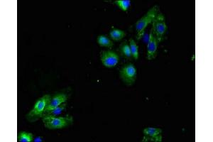 Immunofluorescent analysis of HepG2 cells using ABIN7158651 at dilution of 1:100 and Alexa Fluor 488-congugated AffiniPure Goat Anti-Rabbit IgG(H+L) (LAX1 抗体  (AA 107-298))