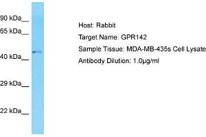 Host: Rabbit Target Name: GPR142 Sample Type: MDA-MB-435s Whole Cell lysates Antibody Dilution: 1. (GPR142 抗体  (N-Term))