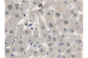 Immunohistochemistry (IHC) image for anti-Chitobiase, Di-N-Acetyl (CTBS) (AA 47-385) antibody (ABIN7436648)