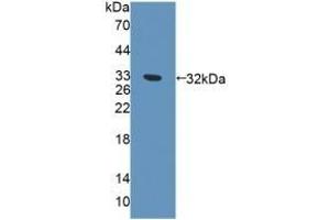 Detection of Recombinant EXO1, Human using Polyclonal Antibody to Exonuclease 1 (EXO1) (Exonuclease 1 抗体  (AA 1-250))