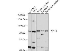 Western blot analysis of extracts of various cell lines, using NELL1 antibody (ABIN6132410, ABIN6144530, ABIN6144531 and ABIN6214585) at 1:1000 dilution. (NELL1 抗体  (AA 160-420))