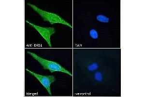 ABIN7013871 Immunofluorescence analysis of paraformaldehyde fixed HeLa cells, permeabilized with 0. (EHD1 抗体  (N-Term))