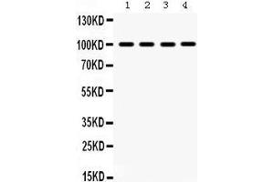 Western Blotting (WB) image for anti-Mitogen-Activated Protein Kinase 6 (MAPK6) (AA 520-721) antibody (ABIN3043611) (MAPK6 抗体  (AA 520-721))