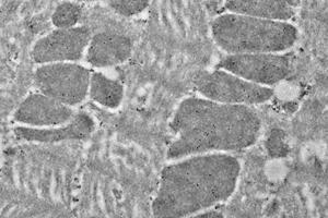 Immunoelectron microscopy analysis of LR white resin-embedded mouse heart using HSP60 (ABIN7074167) at dilution of 1: 50. (HSPD1 抗体)