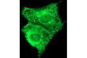 Image no. 3 for anti-Fetal and Adult Testis Expressed 1 (FATE1) antibody (ABIN1498224) (FATE1 抗体)