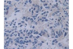 Immunohistochemistry (IHC) image for anti-Tyrosyl-tRNA Synthetase (Yars) (AA 2-528) antibody (ABIN7443434)