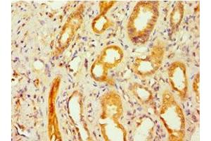 Immunohistochemistry of paraffin-embedded human kidney tissue using ABIN7153663 at dilution of 1:100 (Non-Syndromic Hearing Impairment Protein 5 (GSDME) (AA 1-260) 抗体)