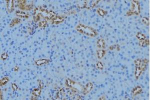 ABIN6279153 at 1/100 staining Mouse kidney tissue by IHC-P.