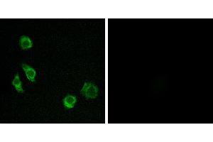 Peptide - +Western blot analysis of extracts from Jurkat cells, using GPRC5D antibody. (GPRC5D 抗体  (Internal Region))