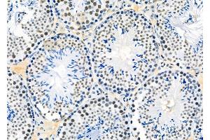 ABIN6265026 and ABIN6273161 at 1/100 staining Mouse testis tissue by IHC-P.