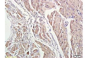 Formalin-fixed and paraffin embedded rat heart labeled with Anti-ROCK1 Polyclonal Antibody, Unconjugated (ABIN738636) at 1:200 followed by conjugation to the secondary antibody and DAB staining.