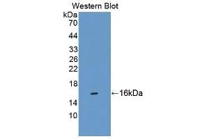 Detection of Recombinant CBY1, Human using Polyclonal Antibody to Chibby Homolog 1 (CBY1) (CBY1/PGEA1 抗体  (AA 12-115))