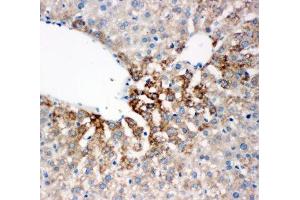 IHC-P: FMO4 antibody testing of rat liver tissue (FMO4 抗体  (N-Term))