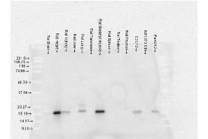 Western Blotting (WB) image for anti-Crystallin, alpha B (CRYAB) antibody (FITC) (ABIN2481828)