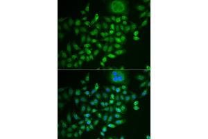 Immunofluorescence analysis of MCF-7 cells using SCG2 antibody (ABIN5973825). (SCG2 抗体)