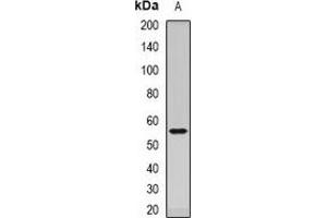Western blot analysis of Dopamine Receptor D5 expression in mouse brain (A) whole cell lysates. (DRD5 抗体)