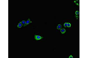 Immunofluorescent analysis of HepG2 cells using ABIN7154769 at dilution of 1:100 and Alexa Fluor 488-congugated AffiniPure Goat Anti-Rabbit IgG(H+L) (GUCY1A1 抗体  (AA 20-152))