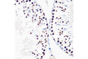 Immunohistochemistry (IHC) image for anti-Myelin Expression Factor 2 (MYEF2) (AA 1-120) antibody (ABIN7268721)