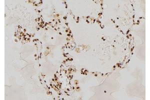 ABIN6277666 at 1/100 staining Human lung tissue by IHC-P. (RAG2 抗体  (N-Term))