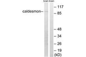 Western blot analysis of extracts from mouse brain cells, using Caldesmon (Ab-759) Antibody. (Caldesmon 抗体  (AA 725-774))