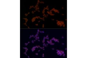 Immunofluorescence analysis of SH-SY5Y cells using SOX11 Rabbit pAb (ABIN7270569) at dilution of 1:100 (40x lens). (SOX11 抗体)