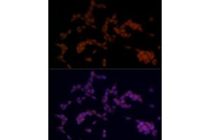 Immunofluorescence analysis of SH-SY5Y cells using SOX11 Rabbit pAb (ABIN7270569) at dilution of 1:100 (40x lens). (SOX11 抗体)