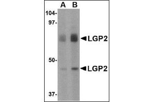 Western blot analysis of LGP2 in rat kidney tissue lysate with this product at (A) 1 and (B) 2 μg/ml. (DHX58 抗体  (Center))