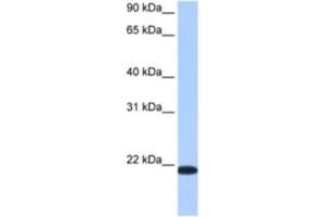 Western Blotting (WB) image for anti-Transmembrane Emp24 Protein Transport Domain Containing 4 (TMED4) antibody (ABIN2462360) (TMED4 抗体)