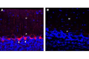 Expression of GABA Transporter 1 in rat cerebellum. (SLC6A1 抗体  (Extracellular))