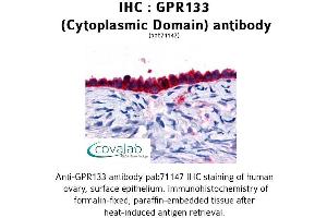 Image no. 1 for anti-G Protein-Coupled Receptor 133 (GPR133) (3rd Cytoplasmic Domain) antibody (ABIN1734933) (G Protein-Coupled Receptor 133 抗体  (3rd Cytoplasmic Domain))