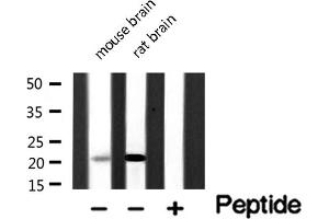 Western blot analysis of CIB2 Antibody expression in Various tissues lysates. (CIB2 抗体  (Internal Region))