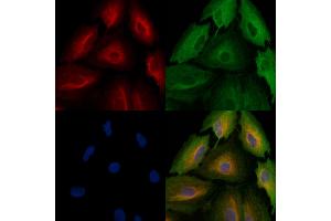 ABIN6257904 and ABIN6274822 staining  cells by IF/ICC. (AARSD1 抗体  (Internal Region))