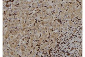 ABIN6273388 at 1/100 staining Human liver tissue by IHC-P. (RIOK2 抗体  (Internal Region))
