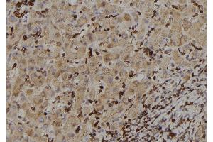 ABIN6273388 at 1/100 staining Human liver tissue by IHC-P. (RIOK2 抗体  (Internal Region))