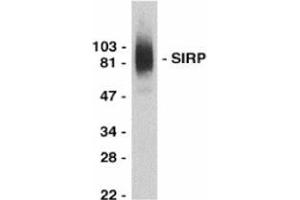 Western blot analysis of SIRP alpha in THP-1 whole cell lysate with this product at 0. (SIRPA 抗体  (C-Term))