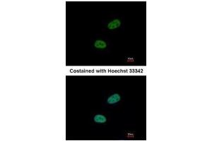 ICC/IF Image Immunofluorescence analysis of paraformaldehyde-fixed HeLa, using SRPX, antibody at 1:500 dilution. (SRPX 抗体)