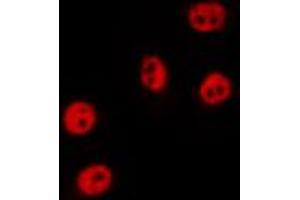 ABIN6274530 staining HepG2 by IF/ICC. (ZAK 抗体  (N-Term))