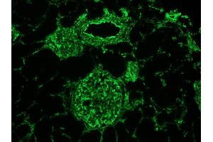Image no. 3 for anti-Vimentin (VIM) antibody (ABIN335382) (Vimentin 抗体)