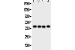 Western Blotting (WB) image for anti-CD34 (CD34) (AA 151-385) antibody (ABIN3043391) (CD34 抗体  (AA 151-385))