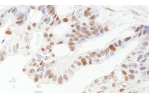 Immunohistochemistry (IHC) image for anti-DNA Fragmentation Factor, 45kDa, alpha Polypeptide (DFFA) (AA 271-331) antibody (ABIN7454749)