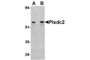 Image no. 1 for anti-Plexin Domain Containing 2 (PLXDC2) (C-Term) antibody (ABIN1492166) (PLXDC2 抗体  (C-Term))