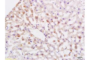 Immunohistochemistry (IHC) image for anti-ATP-Binding Cassette, Sub-Family G (WHITE), Member 5 (ABCG5) (AA 251-350) antibody (ABIN708371)