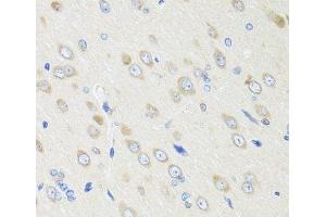 Immunohistochemistry of paraffin-embedded Rat brain using CRABP2 Polyclonal Antibody at dilution of 1:100 (40x lens). (CRABP2 抗体)