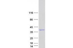 Western Blotting (WB) image for Uridine Phosphorylase 1 (UPP1) (Transcript Variant 1) protein (Myc-DYKDDDDK Tag) (ABIN2735067)
