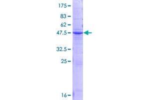 Orosomucoid 2 Protein (ORM2) (AA 1-201) (GST tag)