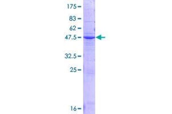 Orosomucoid 2 Protein (ORM2) (AA 1-201) (GST tag)